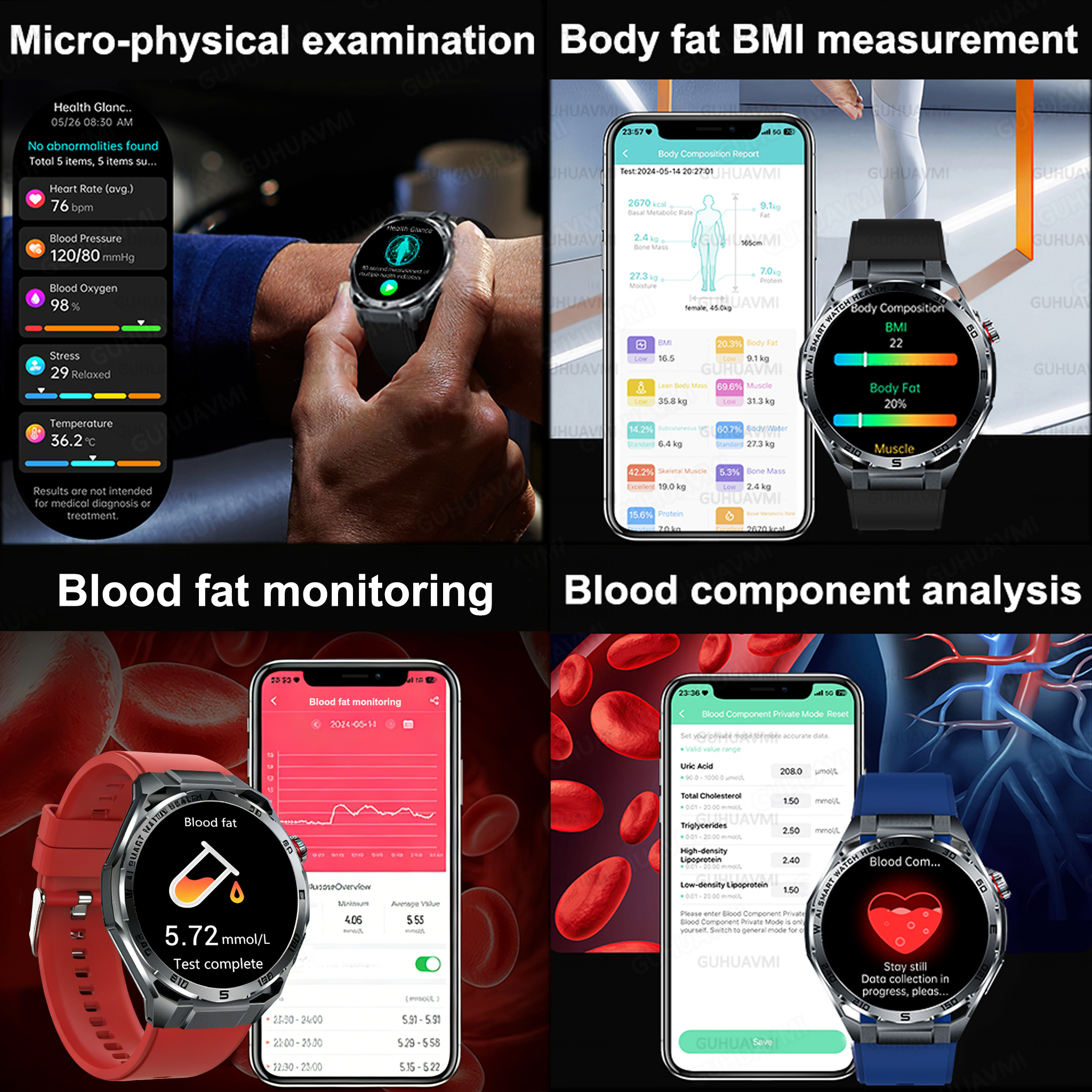 2026 New Body Fat AI Analysis  – обзор и цена Android Smartwatch Accessories